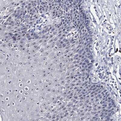 Immunohistochemistry-Paraffin: PCGF5 Antibody [NBP1-82745] - Staining of human esophagus shows nucleolar positivity in squamous epithelial cells.