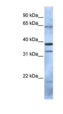 Western Blot: PCGF5 Antibody [NBP1-55283] - 293T cells lysate, concentration 0.2-1 ug/ml.