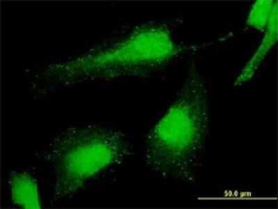 Immunocytochemistry/Immunofluorescence: PCGF6 Antibody (2B8) [H00084108-M01] - Analysis of monoclonal antibody to PCGF6 on HeLa cell . Antibody concentration 10 ug/ml.