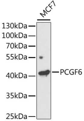 Western Blot: PCGF6 Antibody [NBP2-93117] - Analysis of extracts of MCF7 cells, using PCGF6 .Exposure time: 120s.