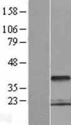 Western Blot: PCGF6 Overexpression Lysate (Adult Normal) [NBP2-06068] Left-Empty vector transfected control cell lysate (HEK293 cell lysate); Right -Over-expression Lysate for PCGF6.