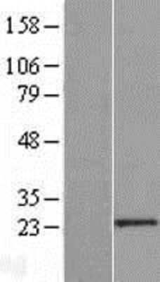 Western Blot: PCGF6 Overexpression Lysate (Adult Normal) [NBP2-08786] Left-Empty vector transfected control cell lysate (HEK293 cell lysate); Right -Over-expression Lysate for PCGF6.