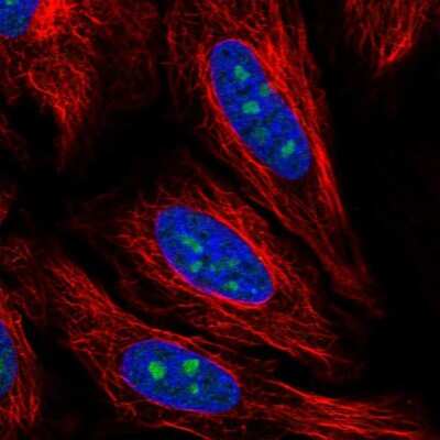 Immunocytochemistry/Immunofluorescence: PCID2 Antibody [NBP2-57674] - Staining of human cell line HeLa shows localization to nucleus & nucleoli.