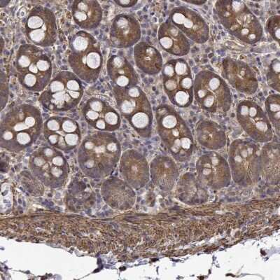 Immunohistochemistry-Paraffin: PCID2 Antibody [NBP2-49586] - Staining of human small intestine shows moderate cytoplasmic positivity in glandular cells and distinctly stained smooth muscle cells.