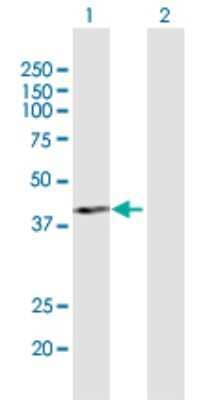 Western Blot PCID2 Antibody