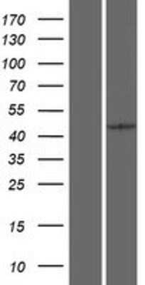 Western Blot: PCID2 Overexpression Lysate (Adult Normal) [NBP2-06809] Left-Empty vector transfected control cell lysate (HEK293 cell lysate); Right -Over-expression Lysate for PCID2.