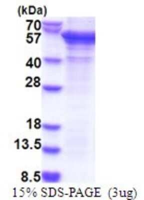 SDS-Page: PCID2 Recombinant Protein [NBP2-51816] - 15% SDS Page (3 ug)