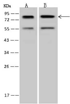 Western Blot: PCIF1 Antibody [NBP2-97683] - Anti-PCIF1 rabbit polyclonal antibody at 1:500 dilution. Lane A: Hela Whole Cell Lysate Lane B: Jurkat Whole Cell Lysate Lysates/proteins at 30 ug per lane. Secondary Goat Anti-Rabbit IgG (H+L)/HRP at 1/10000 dilution. Developed using the ECL technique. Performed under reducing conditions. Predicted band size: 81 kDa. Observed band size: 81 kDa.