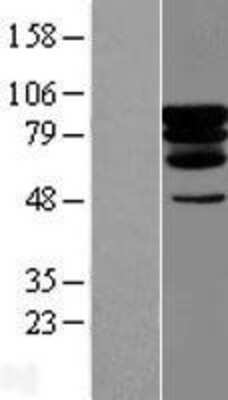 Western Blot: PCIF1 Overexpression Lysate (Adult Normal) [NBL1-14178] Left-Empty vector transfected control cell lysate (HEK293 cell lysate); Right -Over-expression Lysate for PCIF1.