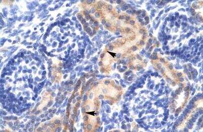 Immunohistochemistry-Paraffin: PCK1 Antibody [NBP1-54825] - Human kidney Tissue, antibody concentration 4-8ug/ml. Cells with positive label: renal corpuscle cells (indicated with arrows) 400X magnification.