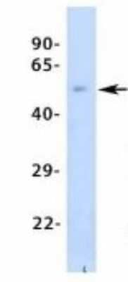 Western Blot: PCK1 Antibody [NBP1-54825] - Human Adult Placenta, Antibody Dilution: 1.0 ug/ml.