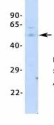 Western Blot: PCK1 Antibody [NBP1-54825] - Human Fetal Liver, Antibody Dilution: 1.0 ug/ml.