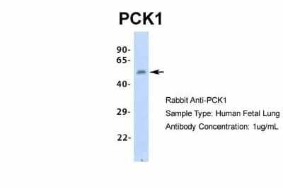 Western Blot: PCK1 Antibody [NBP1-54825] - Human Fetal Lung, Antibody Dilution: 1.0 ug/ml.