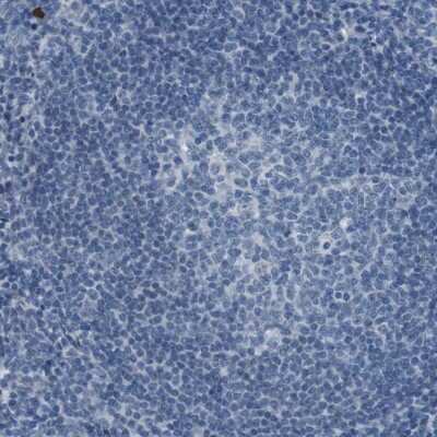Immunohistochemistry-Paraffin: PCLKC Antibody [NBP1-92246] - Staining of human tonsil shows no membranous positivity as expected.