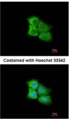 Immunocytochemistry/Immunofluorescence: PCMT1 Antibody [NBP1-33019] - Analysis of methanol-fixed A431, using antibody at 1:200 dilution.