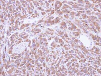 Immunohistochemistry-Paraffin: PCMT1 Antibody [NBP1-33019] - Paraffin-embedded U87 xenograft, using antibody at 1:500 dilution.