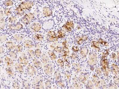 Immunohistochemistry-Paraffin: PCMT1 Antibody [NBP2-97711] - Immunochemical staining of human PCMT1 in human stomach with rabbit polyclonal antibody at 1:300 dilution, formalin-fixed paraffin embedded sections.