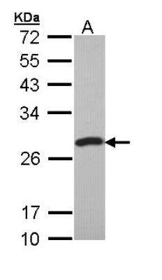 Western Blot: PCMT1 Antibody [NBP1-33019] -  A: 293T.