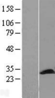 Western Blot: PCMT1 Overexpression Lysate (Adult Normal) [NBL1-14181] Left-Empty vector transfected control cell lysate (HEK293 cell lysate); Right -Over-expression Lysate for PCMT1.