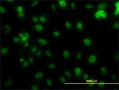 Immunocytochemistry/Immunofluorescence: PCNA Antibody (1G7) [H00005111-M02] - Analysis of monoclonal antibody to PCNA on HeLa cell. Antibody concentration 10 ug/ml.