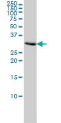 Western Blot: PCNA Antibody (1G7) [H00005111-M02] - PCNA monoclonal antibody (M02), clone 1G7 Analysis of PCNA expression in Hela.