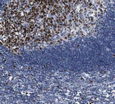 Immunohistochemistry-Paraffin: PCNA Antibody [NBP1-89434] - Staining of human lymph node shows strong nuclear positivity in germinal center cells.