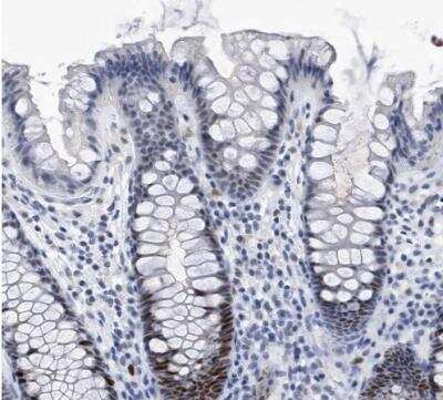 Immunohistochemistry-Paraffin: PCNA Antibody [NBP1-89434] - Staining of human colon shows strong nuclear positivity in glandular cells.