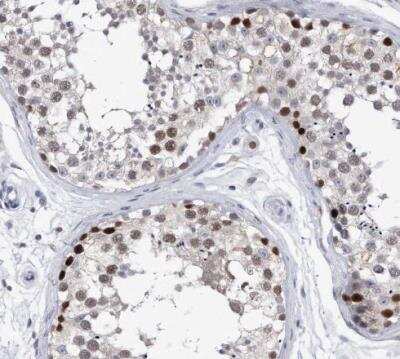 Immunohistochemistry-Paraffin: PCNA Antibody [NBP1-89434] - Staining of human testis shows moderate nuclear positivity in cells in seminiferous ducts.