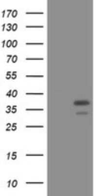 Western Blot: PCNA Antibody (OTI3D6) - Azide and BSA Free [NBP2-73271] - Analysis of HEK293T cells were transfected with the pCMV6-ENTRY control (Left lane) or pCMV6-ENTRY PCNA.