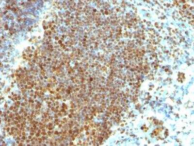 Immunohistochemistry-Paraffin: PCNA Antibody (PCNA/694) - IHC-Prediluted [NBP2-48284] - Human Tonsil stained with PCNA Monoclonal Antibody (PCNA/694)