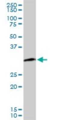 Western Blot: PCNA Antibody (S1) [H00005111-M04] - Analysis of PCNA expression in PC-12 (Cat # L012V1).