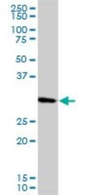 Western Blot: PCNA Antibody (S1) [H00005111-M04] - Analysis of PCNA expression in Raw 264.7 (Cat # L024V1).