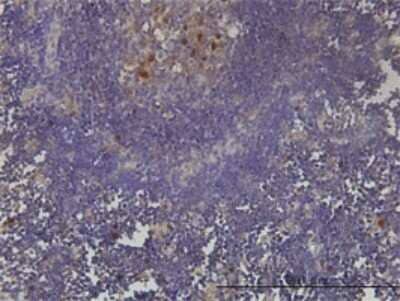Immunohistochemistry-Paraffin PCNA associated factor Antibody (3C11-1F11) - Azide and BSA Free