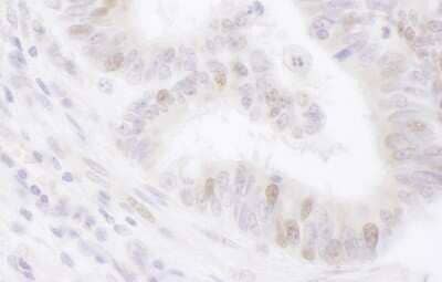 Immunohistochemistry-Paraffin PCNA associated factor Antibody - BSA Free