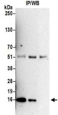 Immunoprecipitation: PCNA associated factor Antibody [NBP2-32117] - Whole cell lysate (0.5 or 1.0 mg per IP reaction; 20% of IP loaded) prepared using RIPA buffer from HeLa cells.  Antibodies:  Affinity purified rabbit anti-PAF antibody NBP2-32117 used for IP at 6 ug per reaction.  PAF was also immunoprecipitated by rabbit anti-PAF antibody NBP2-32117.  For blotting immunoprecipitated PAF, NBP2-32117 was used at 1 ug/ml.  Detection: Chemiluminescence with an exposure time of 3 minutes.