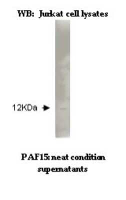 Western Blot: PCNA associated factor Antibody (K11-P1G7/B8) [NBP2-50536] - Analysis of PCNA in Jurkat cell lysates.