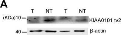 Western Blot PCNA associated factor Antibody - BSA Free