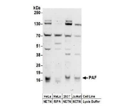 Western Blot PCNA associated factor Antibody - BSA Free