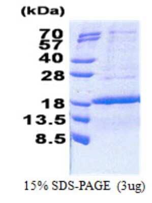 SDS-Page: PCNA associated factor Protein [NBP2-23168]