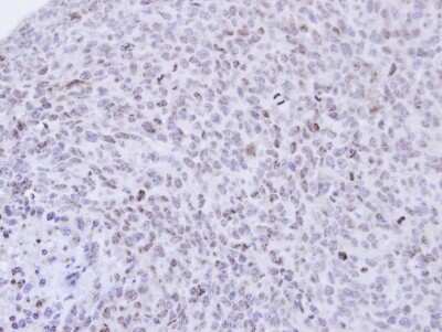 Immunohistochemistry-Paraffin: PCNP Antibody [NBP1-31692] - Paraffin-embedded H1299 xenograft, using antibody at 1:500 dilution.