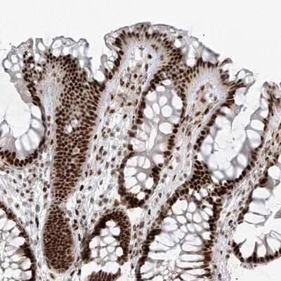 Immunohistochemistry-Paraffin PCNP Antibody - BSA Free