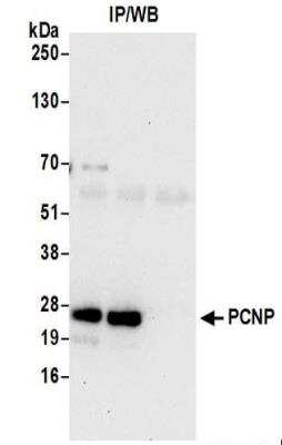 <b>Biological Strategies Validation. </b>Immunoprecipitation: PCNP Antibody [NBP2-37692] - Whole cell lysate (0.5 or 1.0 mg per IP reaction; 20% of IP loaded) from 293T cells prepared using NETN lysis buffer. Affinity purified rabbit anti-PCNP antibody used for IP at 6 ug per reaction.  PCNP was also immunoprecipitated by rabbit anti-PCNP antibody.  For blotting immunoprecipitated PCNP,  was used at 0.04 ug/ml.  Detection: Chemiluminescence with an exposure time of 30 seconds.
