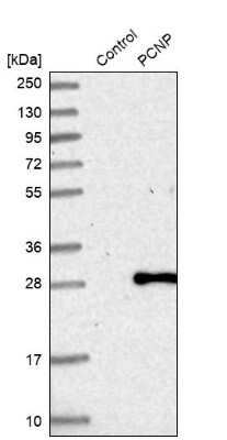 Western Blot PCNP Antibody - BSA Free