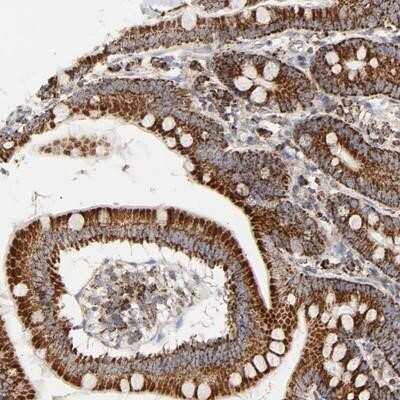 Immunohistochemistry: PCNXL4 Antibody [NBP1-87597] - Staining of human small intestine shows strong cytoplasmic positivity, with a granular pattern, in glandular cells.