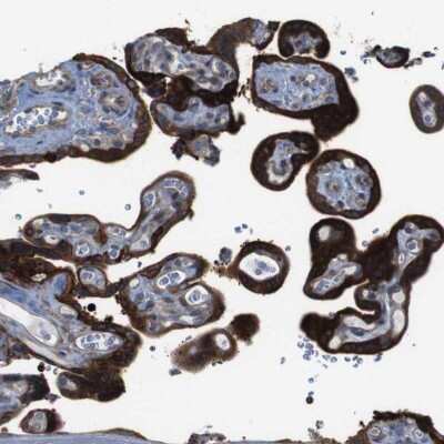 Immunohistochemistry-Paraffin PCOLCE2 Antibody