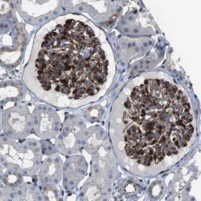 Immunohistochemistry-Paraffin PCOLCE2 Antibody