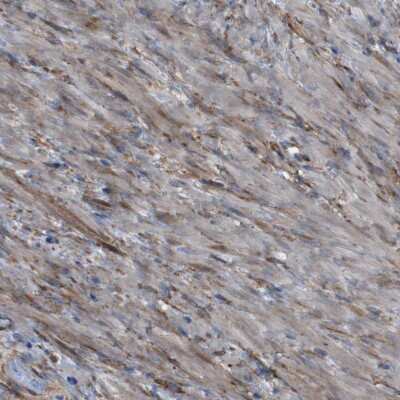 Immunohistochemistry-Paraffin: PCOLCE2 Antibody [NBP1-80935] - Staining shows moderate cytoplasmic positivity in smooth muscle cells.