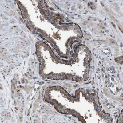 Immunohistochemistry-Paraffin: PCOLCE2 Antibody [NBP1-80935] - Staining of human prostate shows strong cytoplasmic positivity in glandular cells.