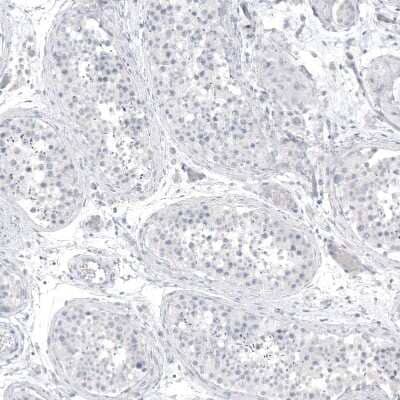 Immunohistochemistry-Paraffin: PCP4 Antibody (CL5306) [NBP2-61410] - Staining of human testis shows no positivity in cells in seminiferous ducts as expected.