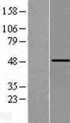 Western Blot: PCPTP1 Overexpression Lysate (Adult Normal) [NBL1-14987] Left-Empty vector transfected control cell lysate (HEK293 cell lysate); Right -Over-expression Lysate for PCPTP1.